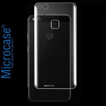 Microcase Huawei P10 Lite Full Arka Kaplama TPU Soft Koruma Film