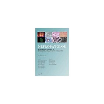 Nefropatoloji - Komisyon