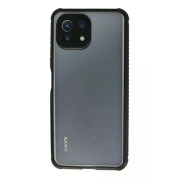 Newface Xiaomi Mİ 11 Lite Miami Şeffaf Silikon Siyah Kılıf