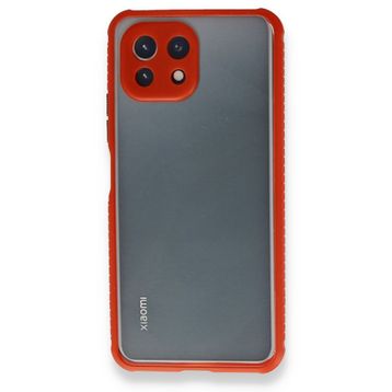 Newface Xiaomi Mİ 11 Lite Miami Şeffaf Silikon Siyah Kılıf