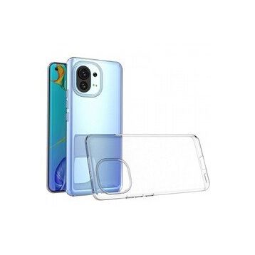 Newface Xiaomi Mi 11 Lüx Şeffaf Silikon Kılıf