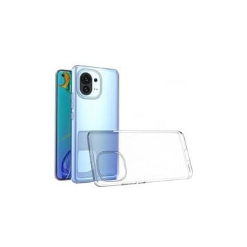 Newface Xiaomi Mi 11 Lüx Şeffaf Silikon Kılıf