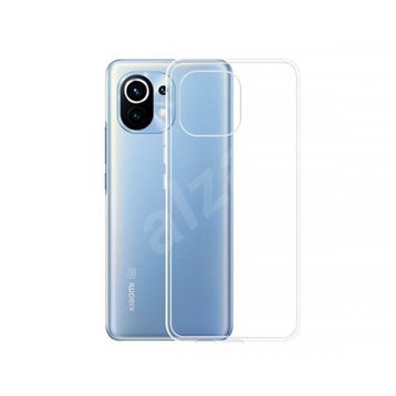 Newface Xiaomi Mi 11 Lüx Şeffaf Silikon Kılıf
