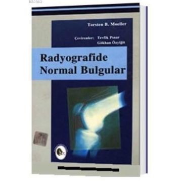 Radyografide Normal Bulgular