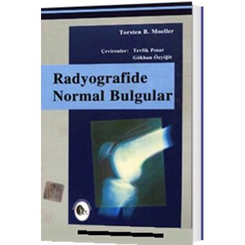 Radyografide Normal Bulgular