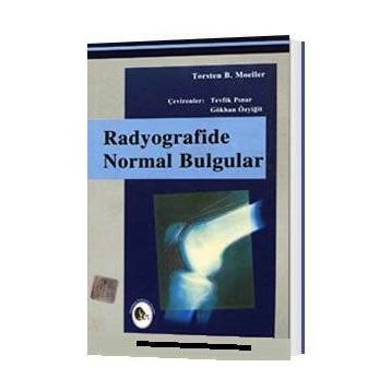 Radyografide Normal Bulgular