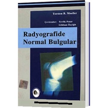 Radyografide Normal Bulgular