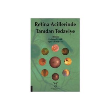 Retina Acillerinde Tanıdan Tedaviye - Kolektif