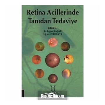 Retina Acillerinde Tanıdan Tedaviye - Kolektif