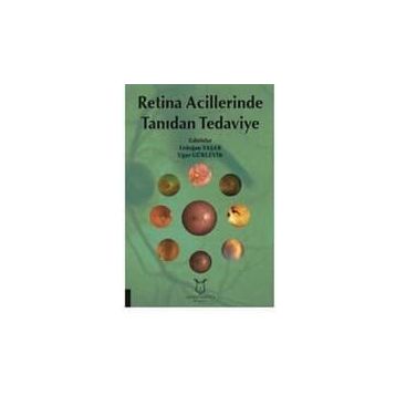 Retina Acillerinde Tanıdan Tedaviye - Kolektif