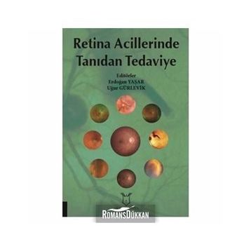 Retina Acillerinde Tanıdan Tedaviye - Kolektif