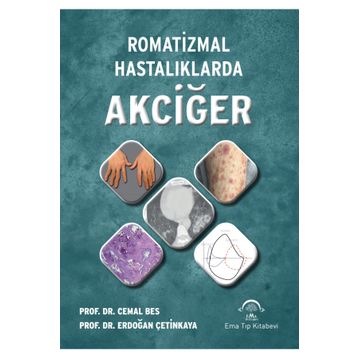 Romatizmal Hastalıklarda Akciğer - Ema Tıp Kitabevi