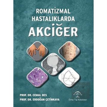 Romatizmal Hastalıklarda Akciğer - Ema Tıp Kitabevi