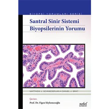 Santral Sinir Sistemi Biyopsilerinin Yorumu - Matthew J. Schniederjan Daniel J. Brat