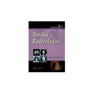 Toraks Radyolojisi - Nobel Tıp Kitabevi