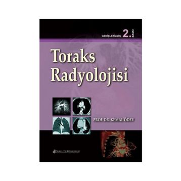 Toraks Radyolojisi - Nobel Tıp Kitabevi