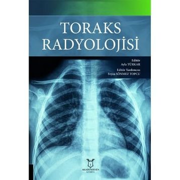 Toraks Radyolojisi - Nobel Tıp Kitabevi