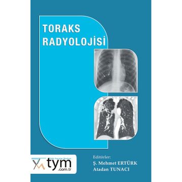 Toraks Radyolojisi - Nobel Tıp Kitabevi