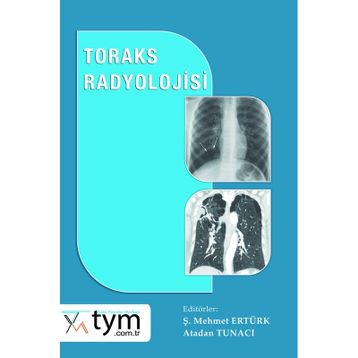 Toraks Radyolojisi - Nobel Tıp Kitabevi