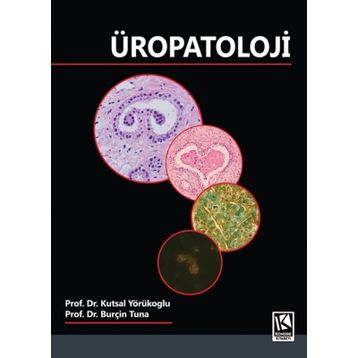 Üropatoloji - YÖRÜKOĞLU TUNA