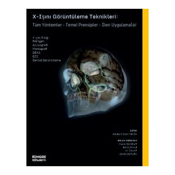 X Işınları Görüntüleme Teknikleri - Kongre Kitabevi