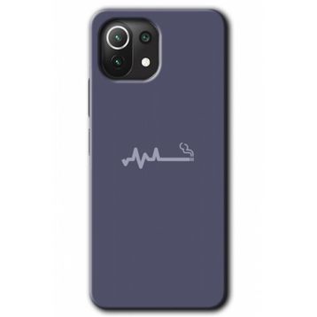 Xiaomi Mi 11 Lite Hd Desen Baskılı Sigara Zararlıdır Arka Kapak Kılıf