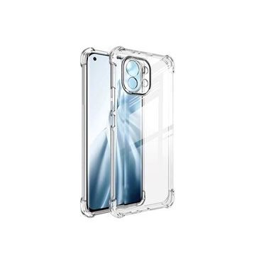Zore Xiaomi Mi 11 Lite Kamera Korumalı Nitro Anti Shock Silikon
