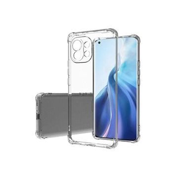 Zore Xiaomi Mi 11 Lite Kamera Korumalı Nitro Anti Shock Silikon