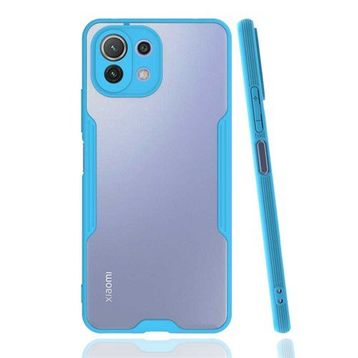 Zore Xiaomi Mi 11 Lite Parfe Kapak Kılıf