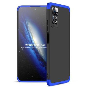 Zore Xiaomi Redmi Note 11 Pro 5G Ays Kılıf
