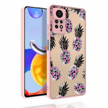Zore Xiaomi Redmi Note 11 Pro 5G Desenli Kamera Korumalı Parlak Nora Kapak Kılıf