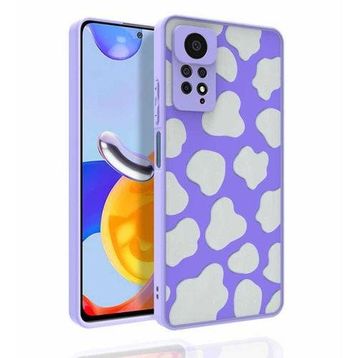Zore Xiaomi Redmi Note 11 Pro 5G Desenli Kamera Korumalı Parlak Nora Kapak Kılıf